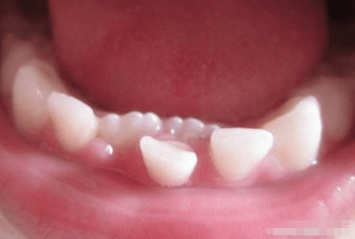 全能辣妈plus|孩子这颗牙有大“作用”，父母别再乱丢了，关键时刻能救娃一命