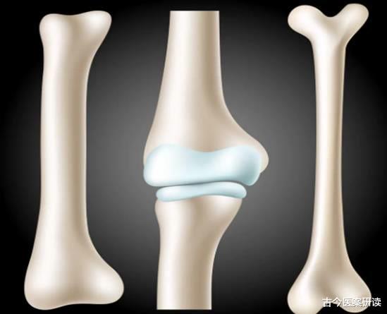 骨质疏松|骨汤并不能补骨！骨科专家：不要执迷不悟了，这3种食物才是“补钙王者”