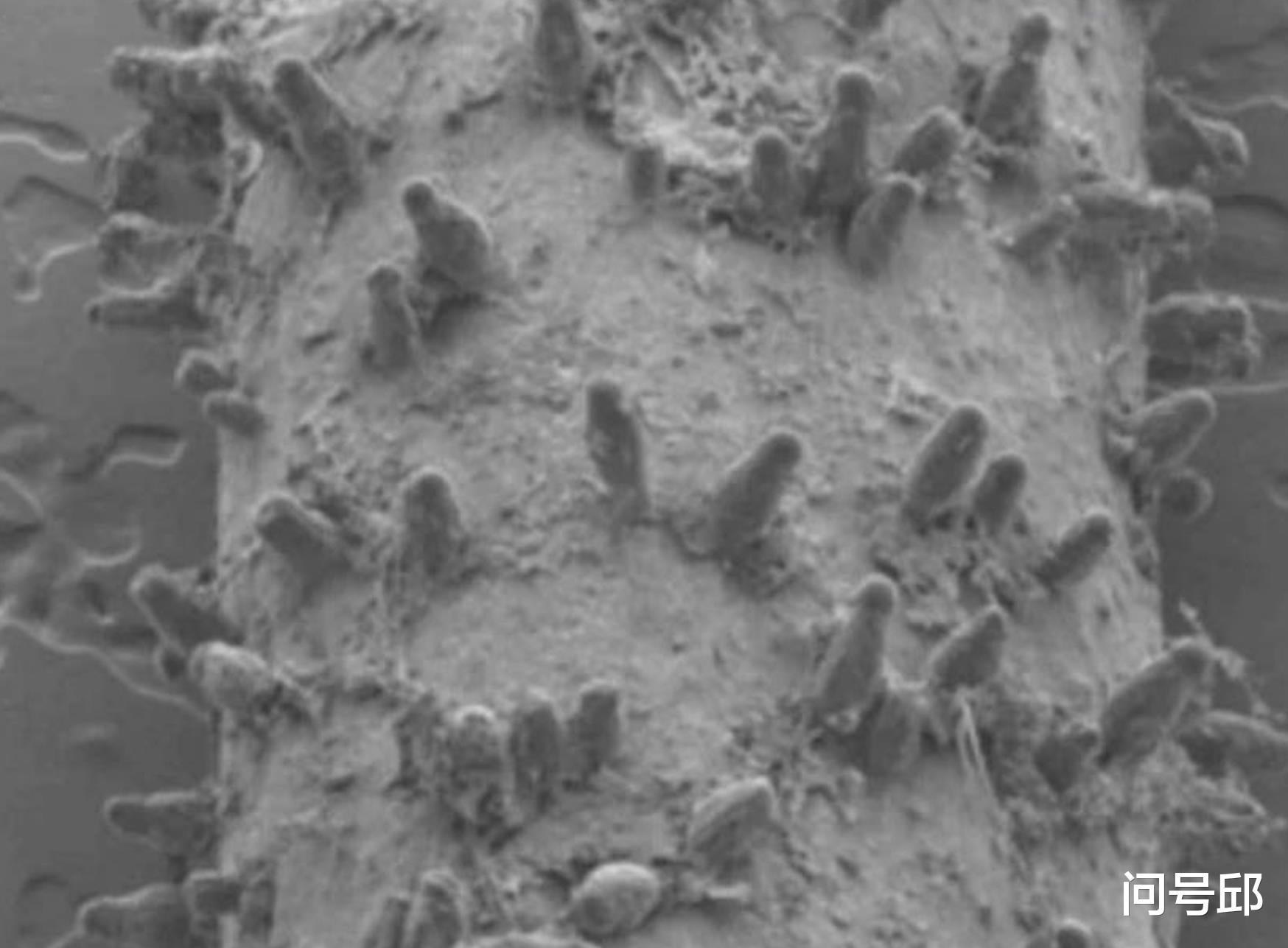 昆虫 专家发现北美有一种野花不光合作用,而是靠茎吸食昆虫的食虫植物