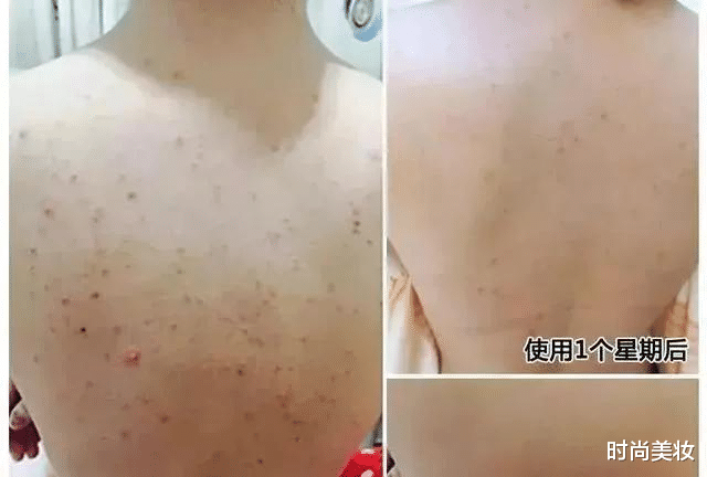 时尚美妆|《美人鱼》捧火的林允，皮肤白皙令人羡慕，其实只做了两件事