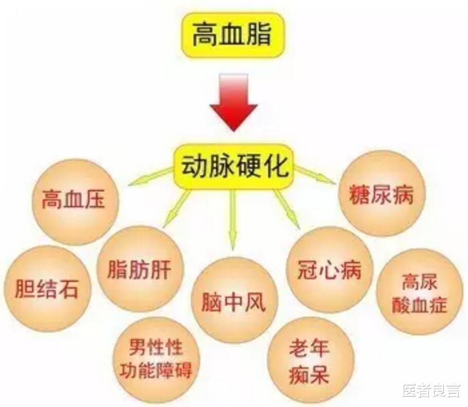 高圆圆 脑梗死预防大于治疗！医生坦言注意几点就可轻松预防