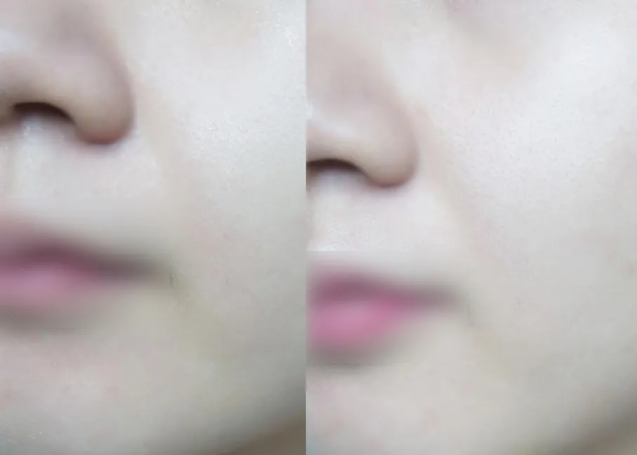 珑阳谈护肤 每天十分钟消除法令纹，填充鼻基底