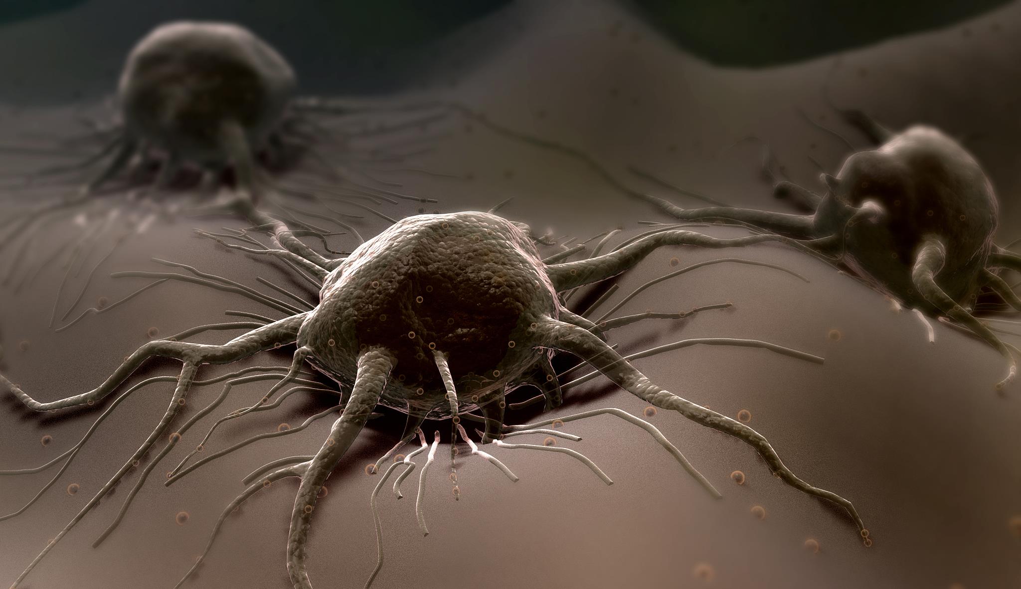 疾病|体内有癌,脚部会出现异常?两种迹象,要多留心了