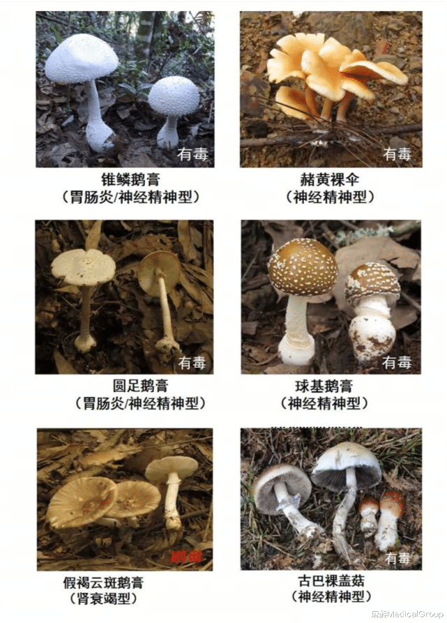 麻醉MedicalGroup|又到了一年吃蘑菇的时节，千万别乱吃，当心蘑菇中毒