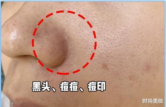 时尚美妆|被埋没在“屈臣氏”爽肤水，导购很少推荐，店员们却私下自己在用