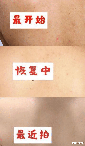 李佳琦|郑爽晒的“续命”护肤好物，5分钟狂卖10000块，李佳琦：比兰蔻好用