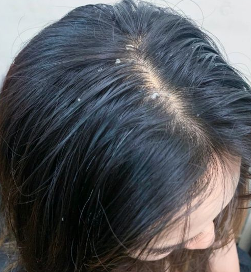 方方看时尚|孕妇公认的洗发水“王者”！能打败油头、头痒，连头屑都措手不及