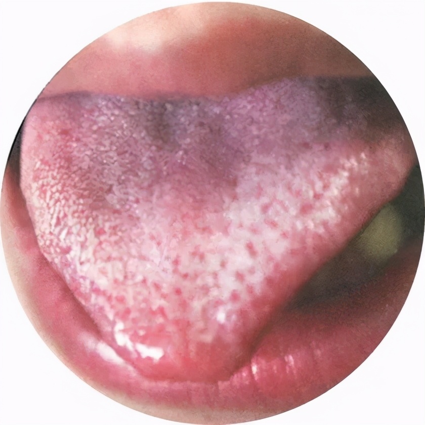 肝脏|祛除体内湿热的方法，家里老人用了几十年的土方子，越简单越有效