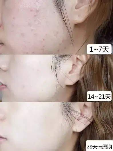 时尚美妆|冻龄女神陈数自创\"洗脸术\",每天10分钟水嫩嫩,网友:效果太好了