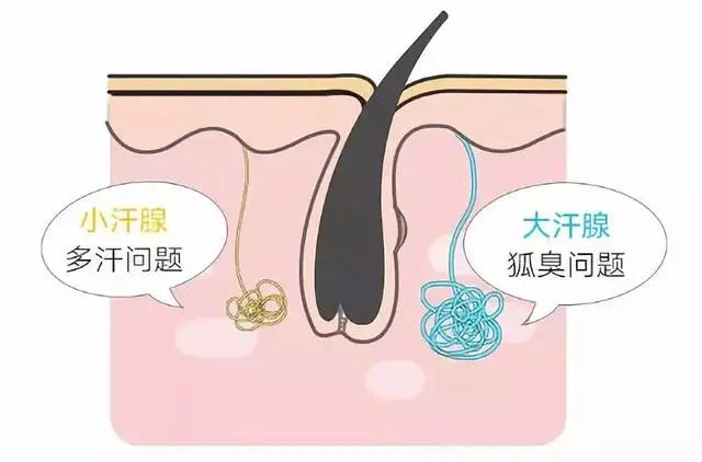 汉方医典通|你知道吗,令人厌烦的狐臭竟然还会遗传!