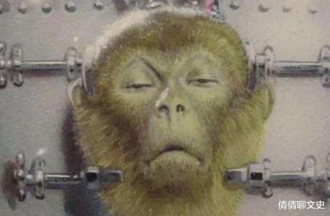 倩倩聊文史 哈医大任晓平：耗资7000万，完成世界首例“换头”手术，结局如何