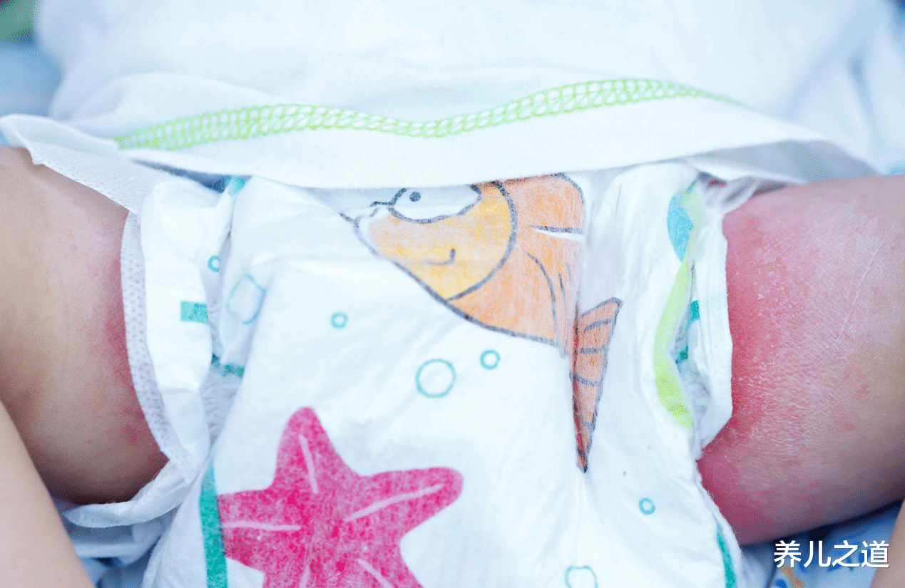 养儿之道|用湿巾给婴儿擦屁股，越用越脏，孩子屁股也越来越红，无知且糊涂