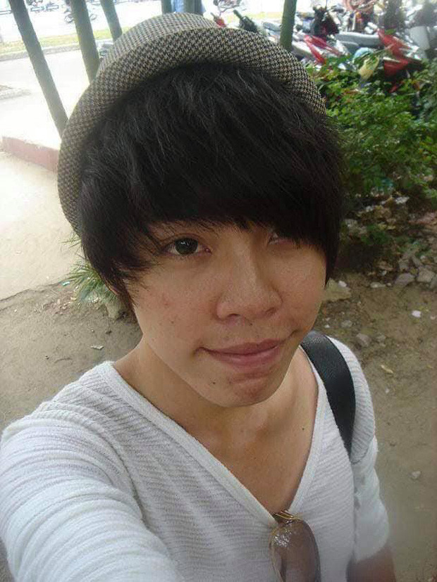 睹图 男子长相丑陋遭人嘲笑长大后整容10次，如今改头换面酷似男明星