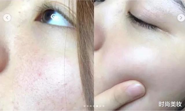 连衣裙|你还敢说护肤是“浪费钱”吗？张雨绮10年前旧照，比现在还老20岁