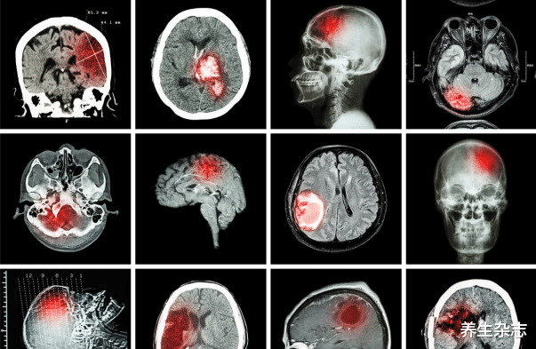 养生杂志|血液的“稀释剂”已找到,不是菊花茶,每天吃一点,扫清血管绊脚石
