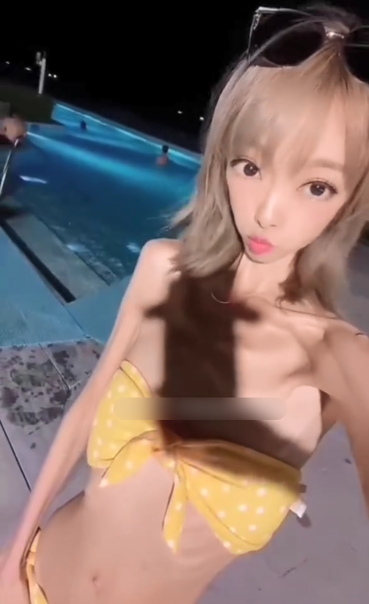 丝芙兰 女网红过度减肥瘦成皮包骨，穿泳衣秀身材胸前肋骨清晰可见