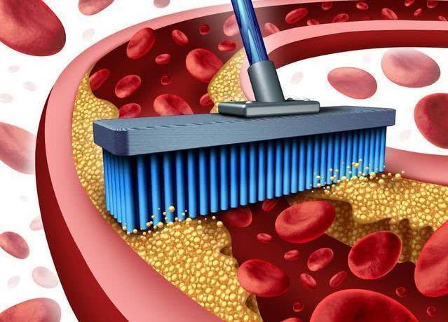 胃黏膜|血脂高的人，要尽早把这3种“素食”列入黑名单，别再摆上餐桌了