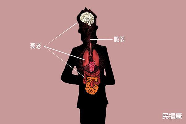 疾病|50岁以后，各种疾病都来了，是咋回事？预防疾病，该怎么做？