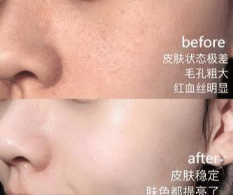 好物官|王鸥最近晒出的一款面膜火了，价格便宜又好用，拯救暗黄干燥肌