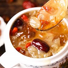 香艾儿|病多是堵出来的！这些疏通法你要知道