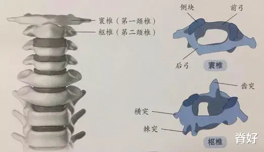 二甲双胍|治了五年的头晕终于找到病因——椎动脉沟环