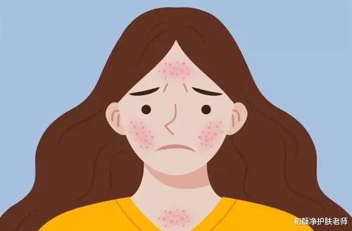 防晒 敏感肌皮肤屏障如何修复？科学自救指南了解一下！