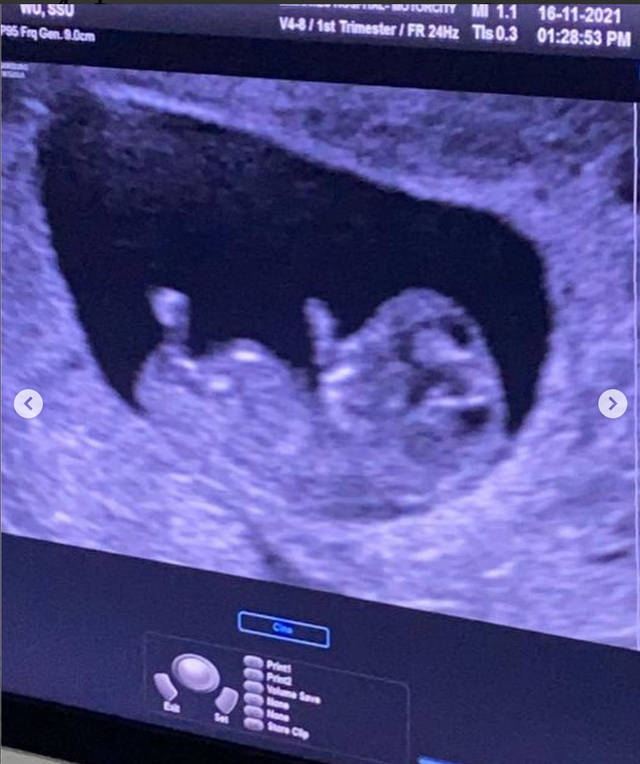 跨年|37岁女星跨年前报喜,高龄怀上二胎已4月,晒儿子摸孕肚照显温馨