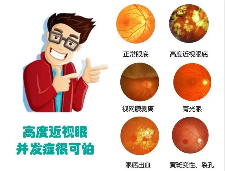 eye沈阳 近视不可怕，一个手术全搞定？