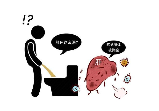 肝癌|你知道吗?肝癌临近时,小便时常有2个特征,若你没有,恭喜你