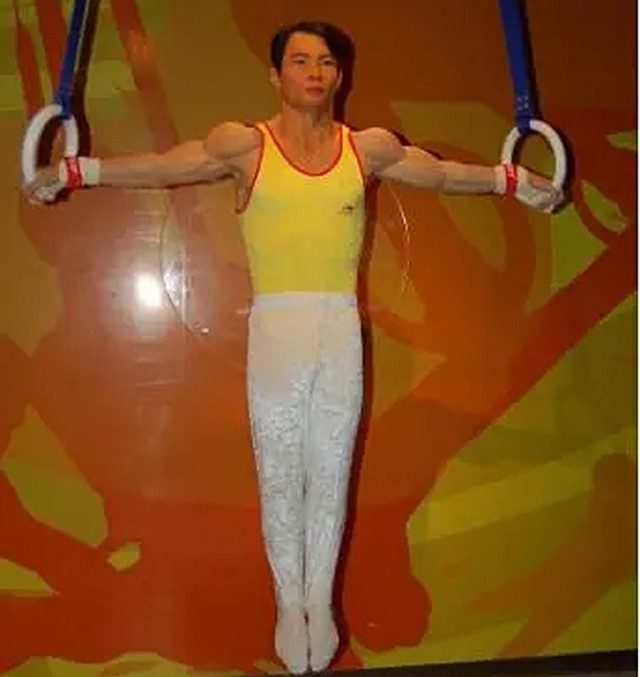 拉齊奧|“雙胞胎冠軍”李大雙李小雙：24歲因身體退役，退役后過得如何？