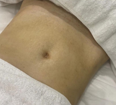 fashion美尚|那些号称可以“预防妊娠纹”的方法和乳油膏霜，原来都是智商税