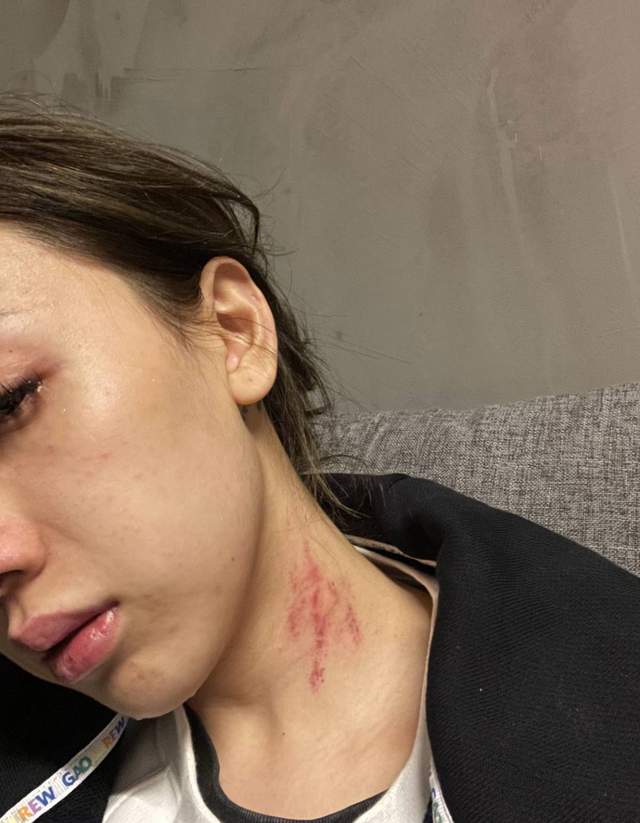 社交平台|贵圈真乱！说唱女歌手称遭到男友家暴：往脸上吐口水，签约君子协议