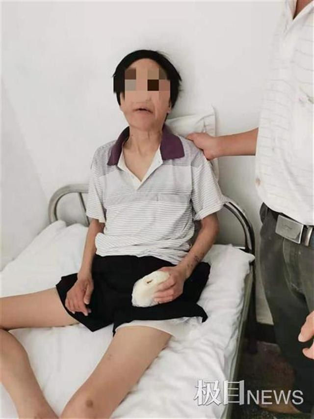 猪肝|20年来每天一斤白酒，喝出“神经病”！到底每天喝多少酒才安全？