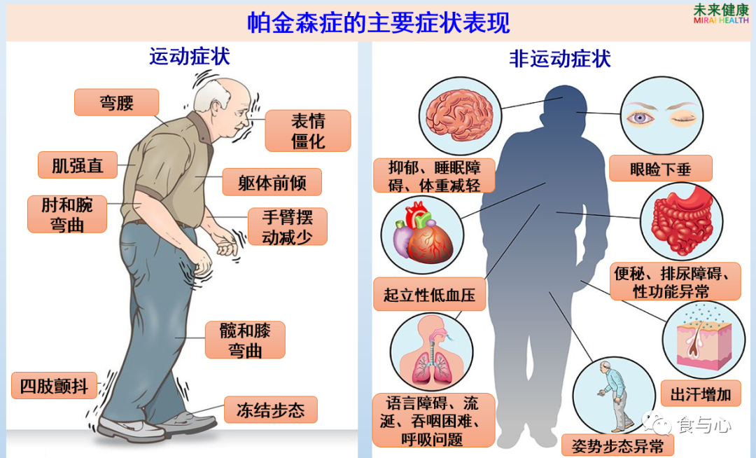 益生菌|补充益生菌能改善帕金森症吗？最新科研结果给出肯定回答