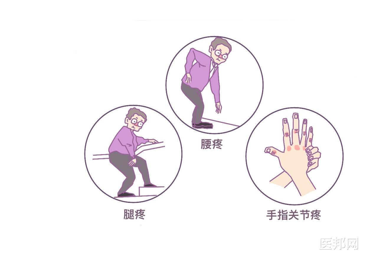 骨关节炎|天气变冷，关节炎频繁发作怎么办？骨关节炎的10大误区你知道吗？