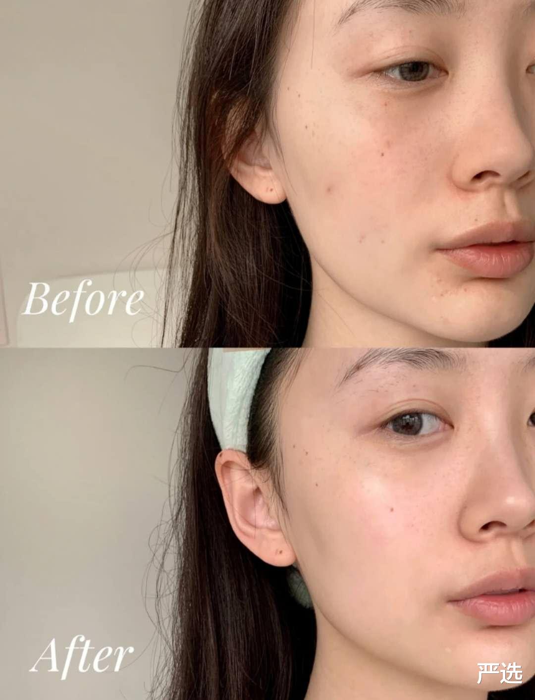 严选|女子为何2个月不敢出门，全是美白面膜惹的祸，网友：中药太害人