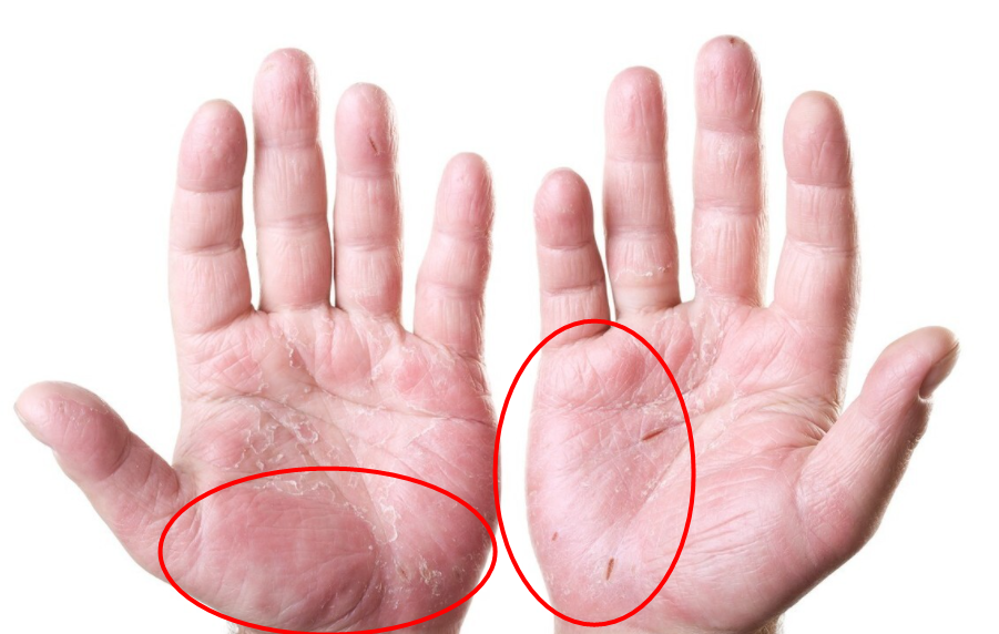 小米粥|吃一次顶10斤李子,肝科主任:你若喜欢喝,趁你睡着肝毒自动排光