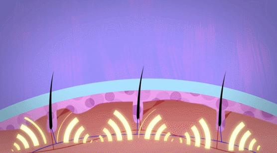 39健康网|长出来的白发，还能变黑吗？中医、西医2种方法，“养”出乌发