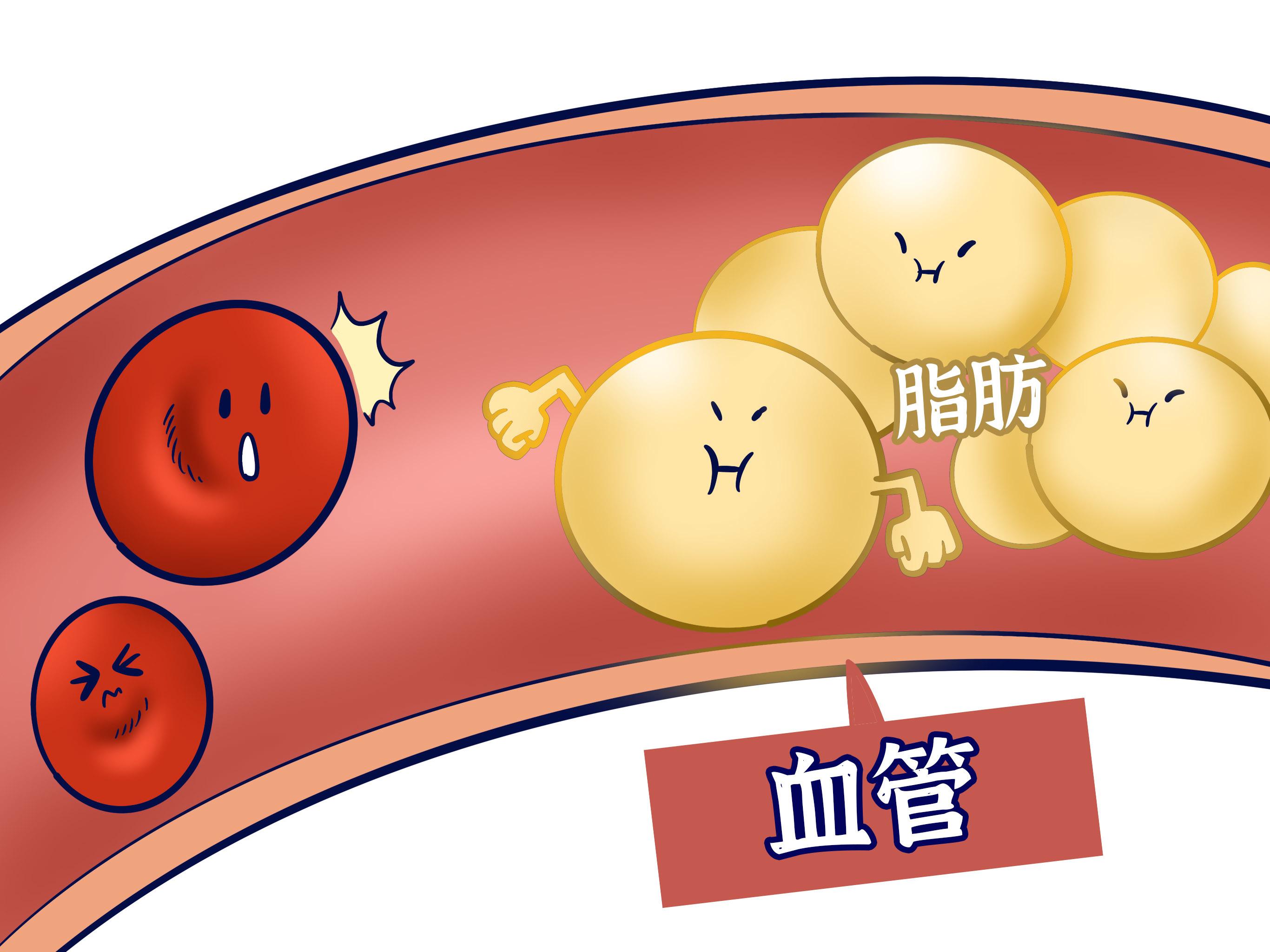 医者荣耀|体内血脂异常，大拇指有这2种表现，这种症状也是血脂异常的表现