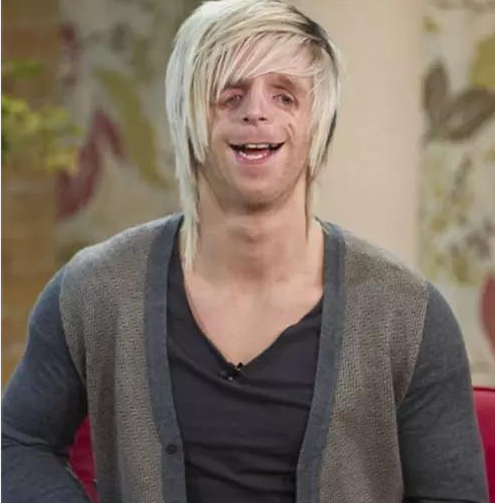 無名可取 外国小伙天生脸部有缺陷，却迎娶当地第一美女，生出来的孩子怎样