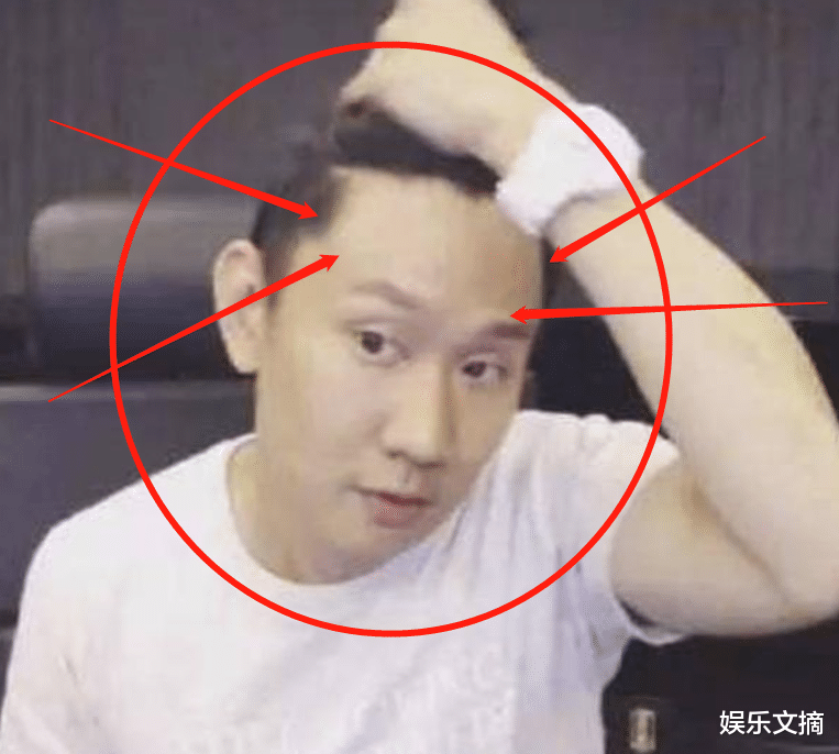 林俊杰|林俊杰终于鼓起勇气掀刘海，看清他的大脑门后，粉丝差点没认出来