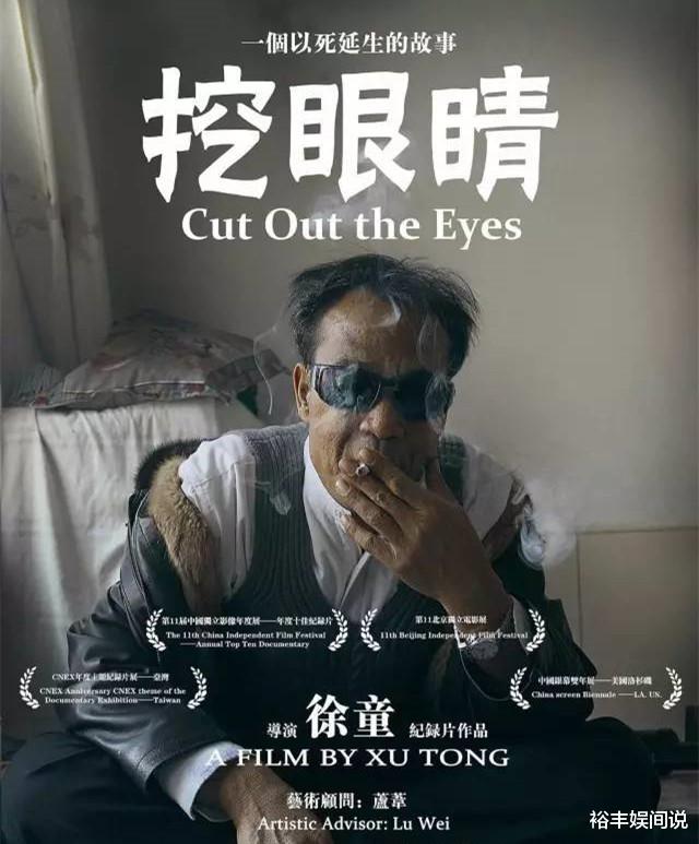 一路走好!知名网红二后生不幸去世,曾被挖双眼晚年患尿毒症