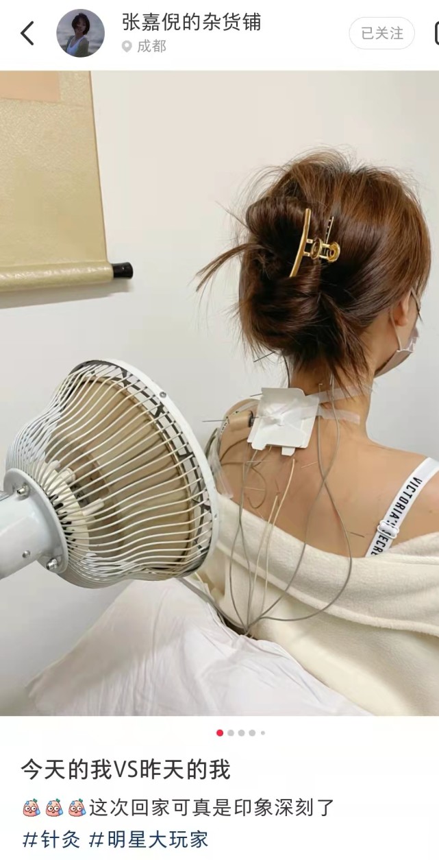 张嘉倪|张嘉倪好拼，前脚在寒风冷水里拍照，后脚就到医院做肩颈针灸，看着好疼