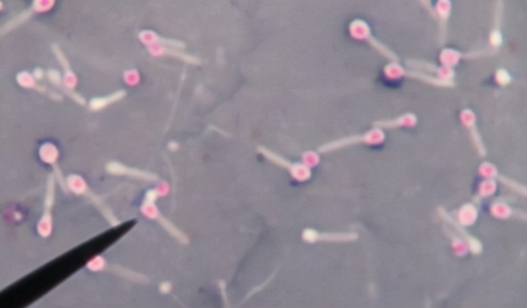 科学家 为了“永生”，科学家做出疯狂举动：往体内注射350万年前的细菌