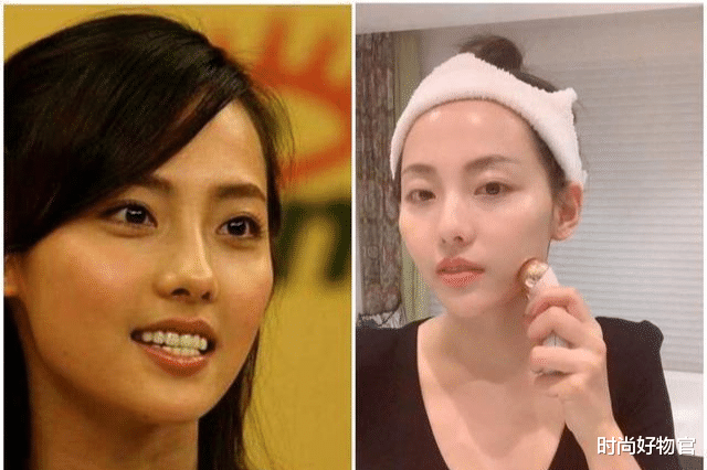 时尚好物官|女子为去皱纹连扎20多针除皱针，竟变成这模样？网友：幸好没跟风