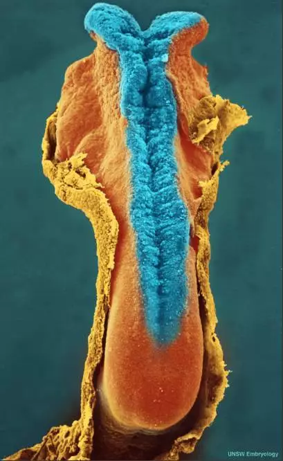  人的7大缺陷，有一个你绝对意想不到~