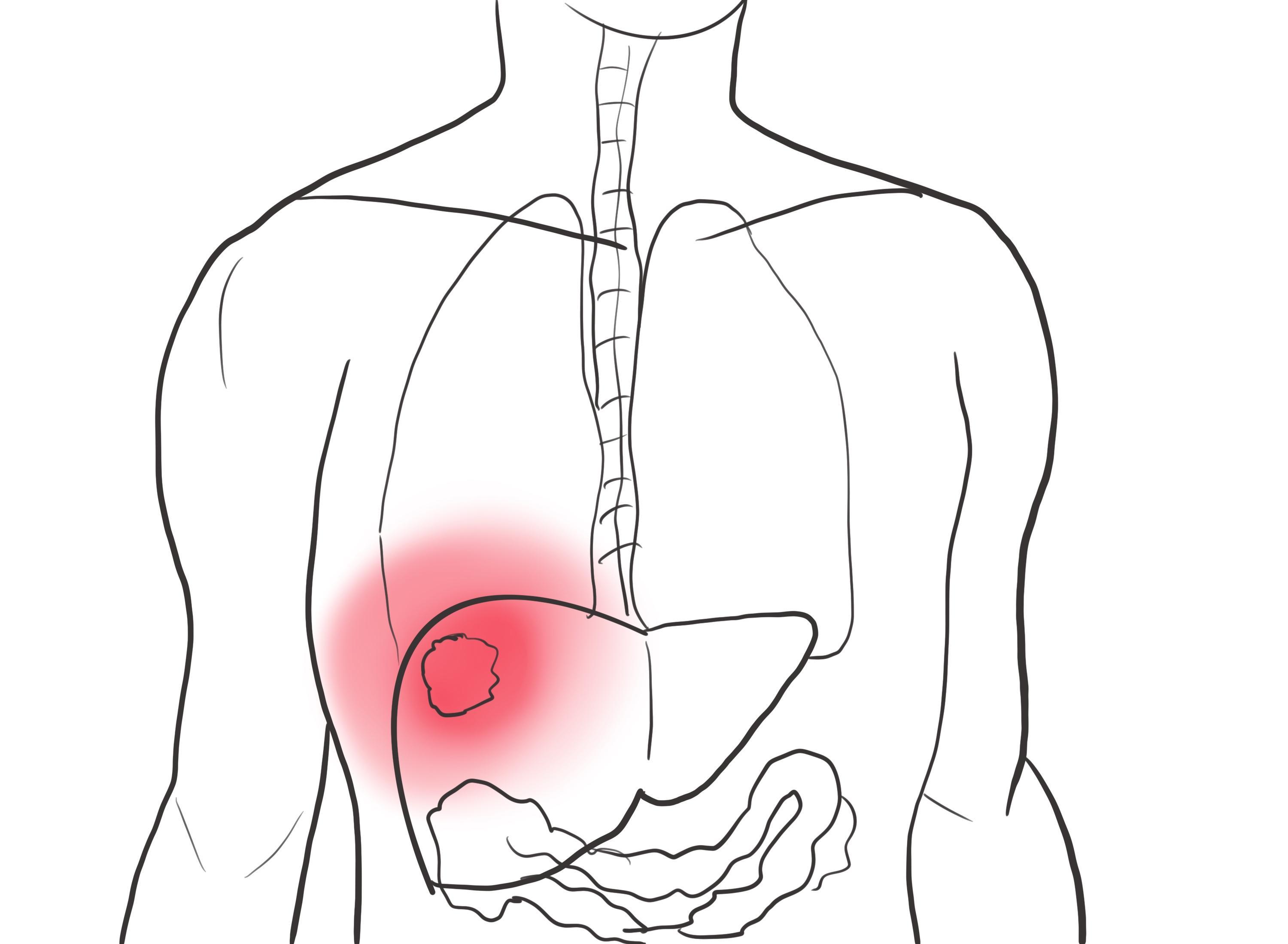 肝脏|肝脏不好的人，这3个部位会有异常，尽早发现，或许还能拯救肝脏