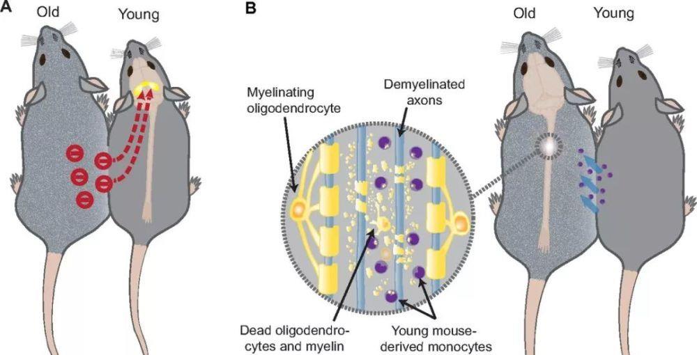 卡尔马 人体换血实验:为了活过120岁换年轻人的血,不违背伦理道德?