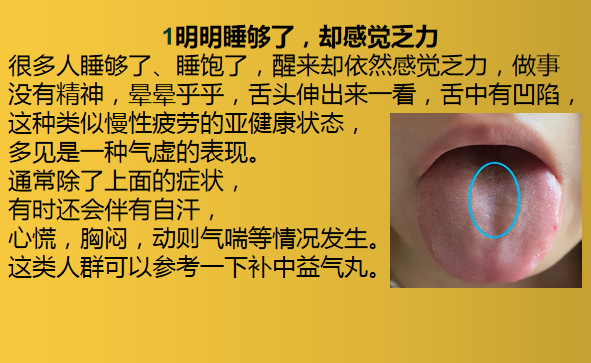药都老和说 为什么睡觉，会越睡越累呢？这6个原因，看看你是哪一种