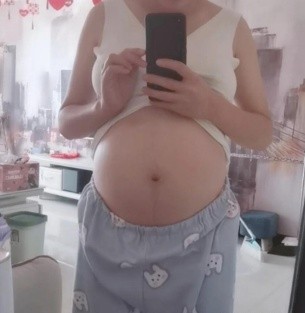 樱桃妈咪|十个妈妈九个长？孕期被妊娠纹“偏爱”？学会4招，远离花肚皮！